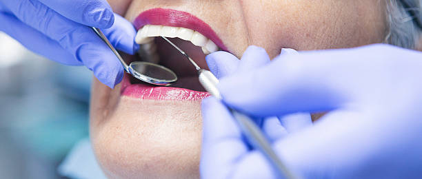 Best Emergency Dental Care for Sports Injuries in Fris, CO